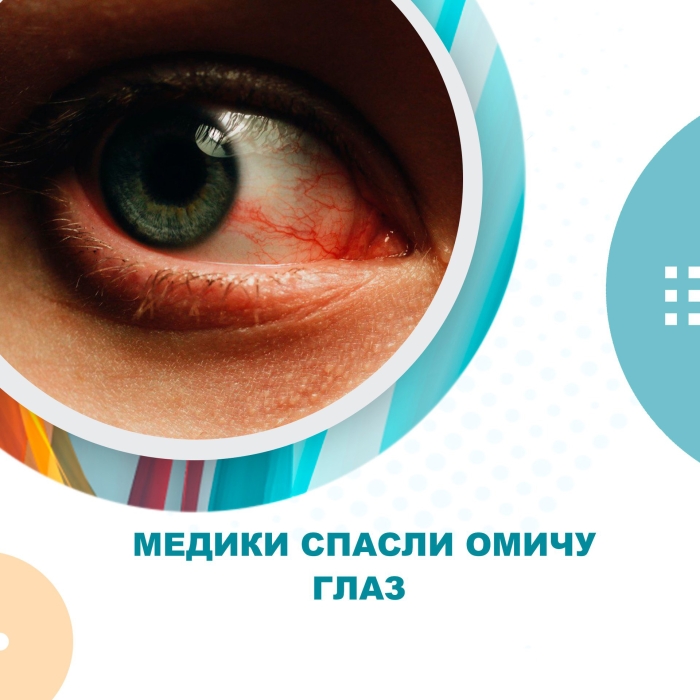 Омич едва не лишился глаза